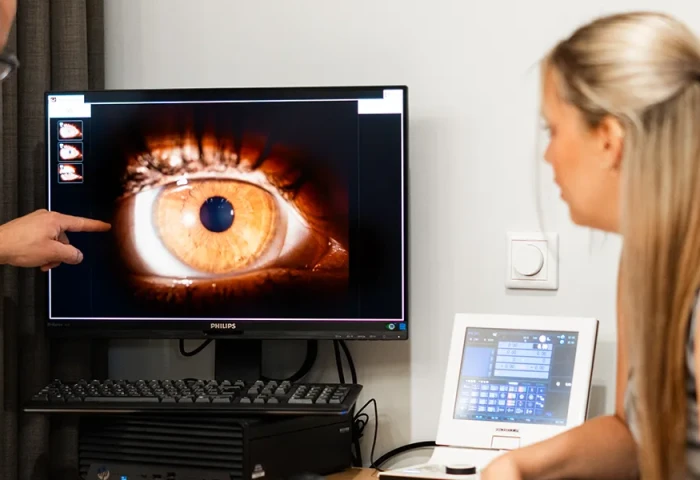 opticien bol